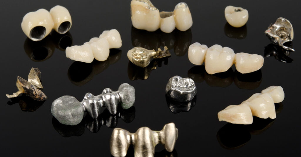 Services 12 5 1 Tijan Dental Center