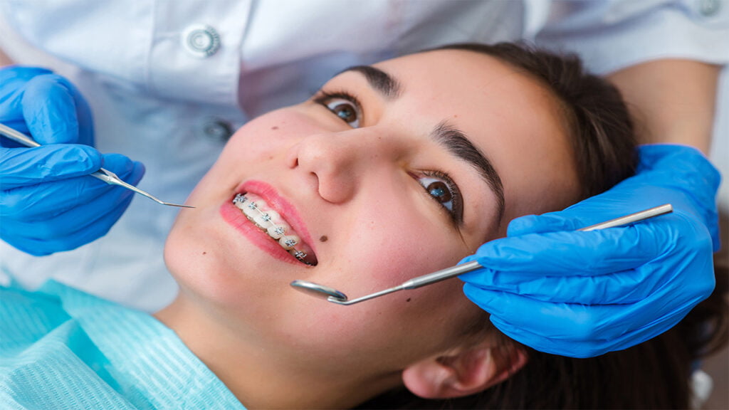 10 معلومات مهمة عن تقويم الأسنان 7 تقويم الأسنان وأنواع التقويم