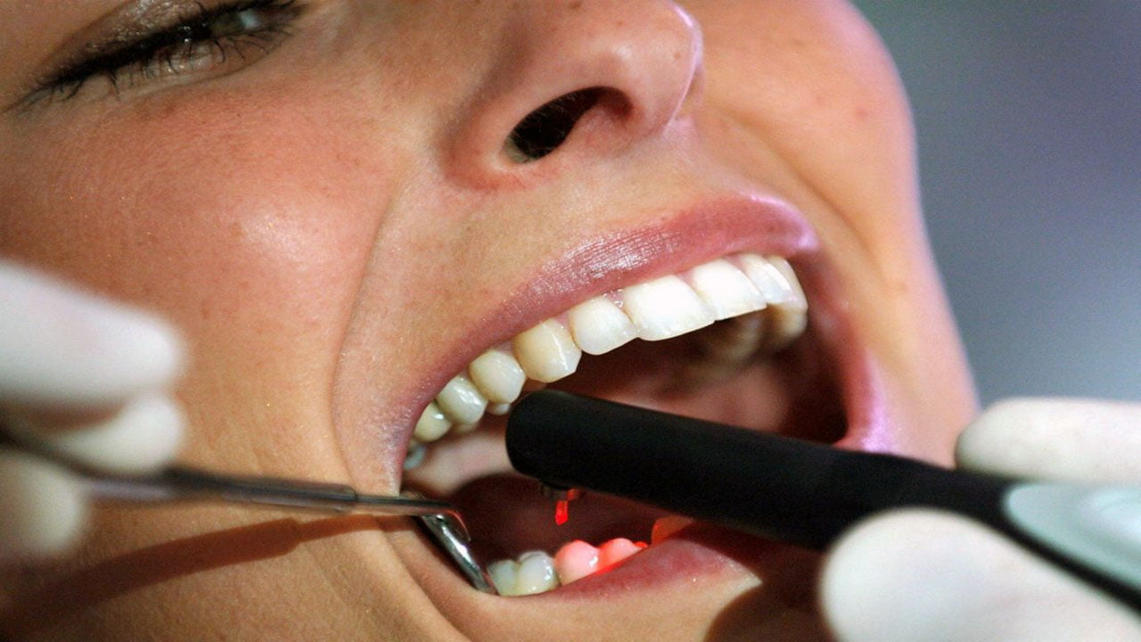 ما يجب أن تعرفه قبل وبعد خلع ضرس العقل - Tijan Dental Center
