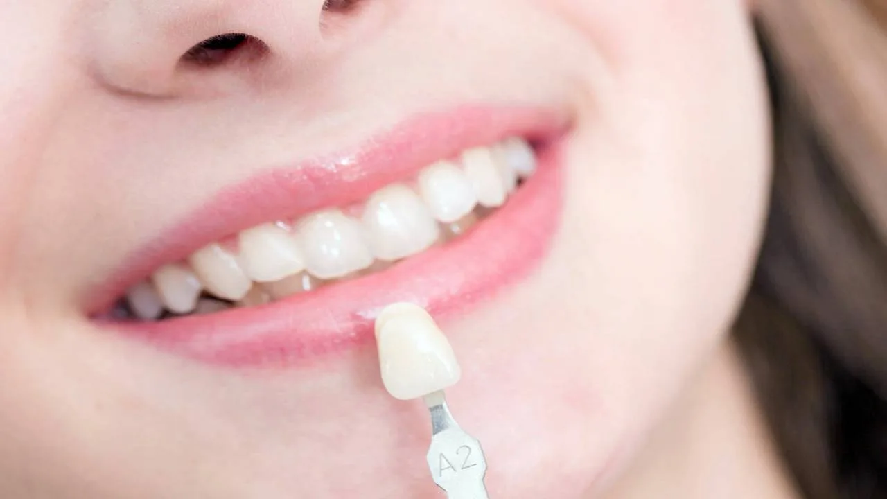 الخلايا الجذعية للأسنان