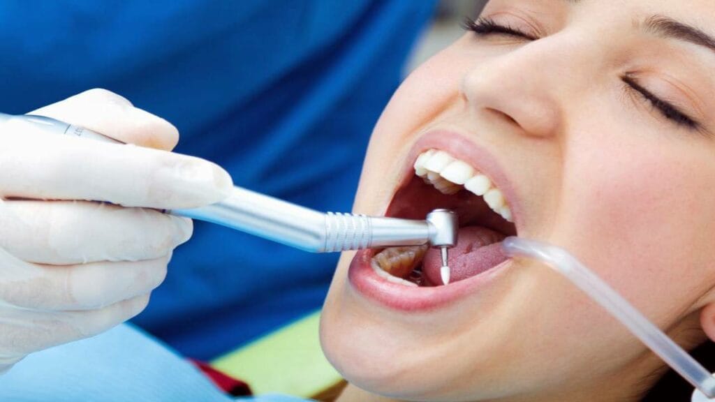 ما هو ترميم الأسنان؟ أهم الأسباب والطرق للتجميل والعلاج 4 ترميم الأسنان