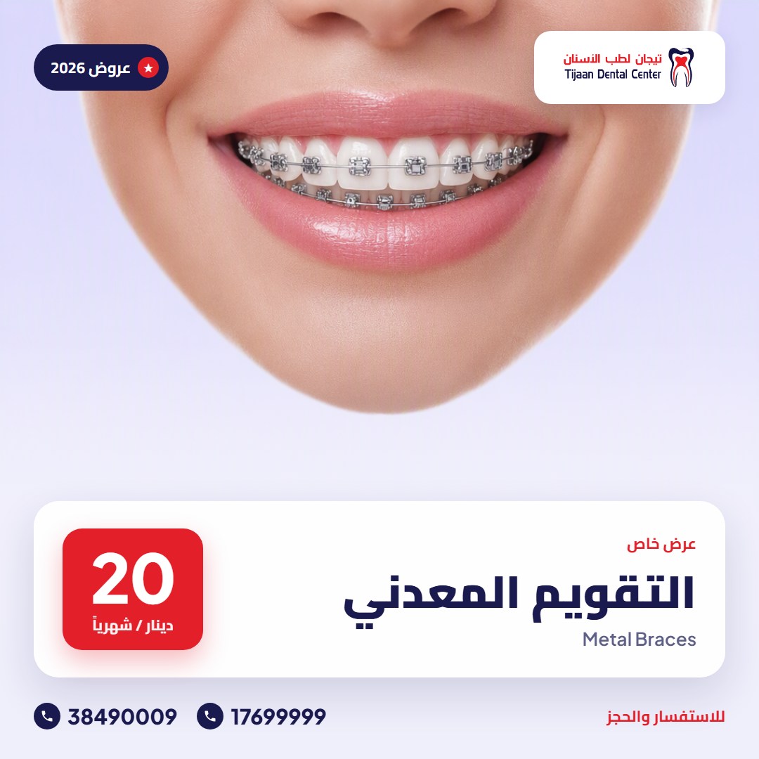 التقويم المعدني