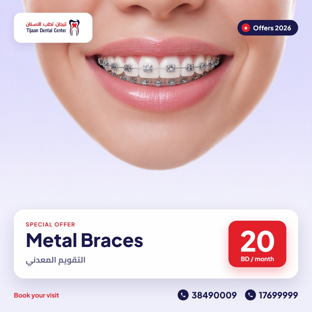 Metal Braces
