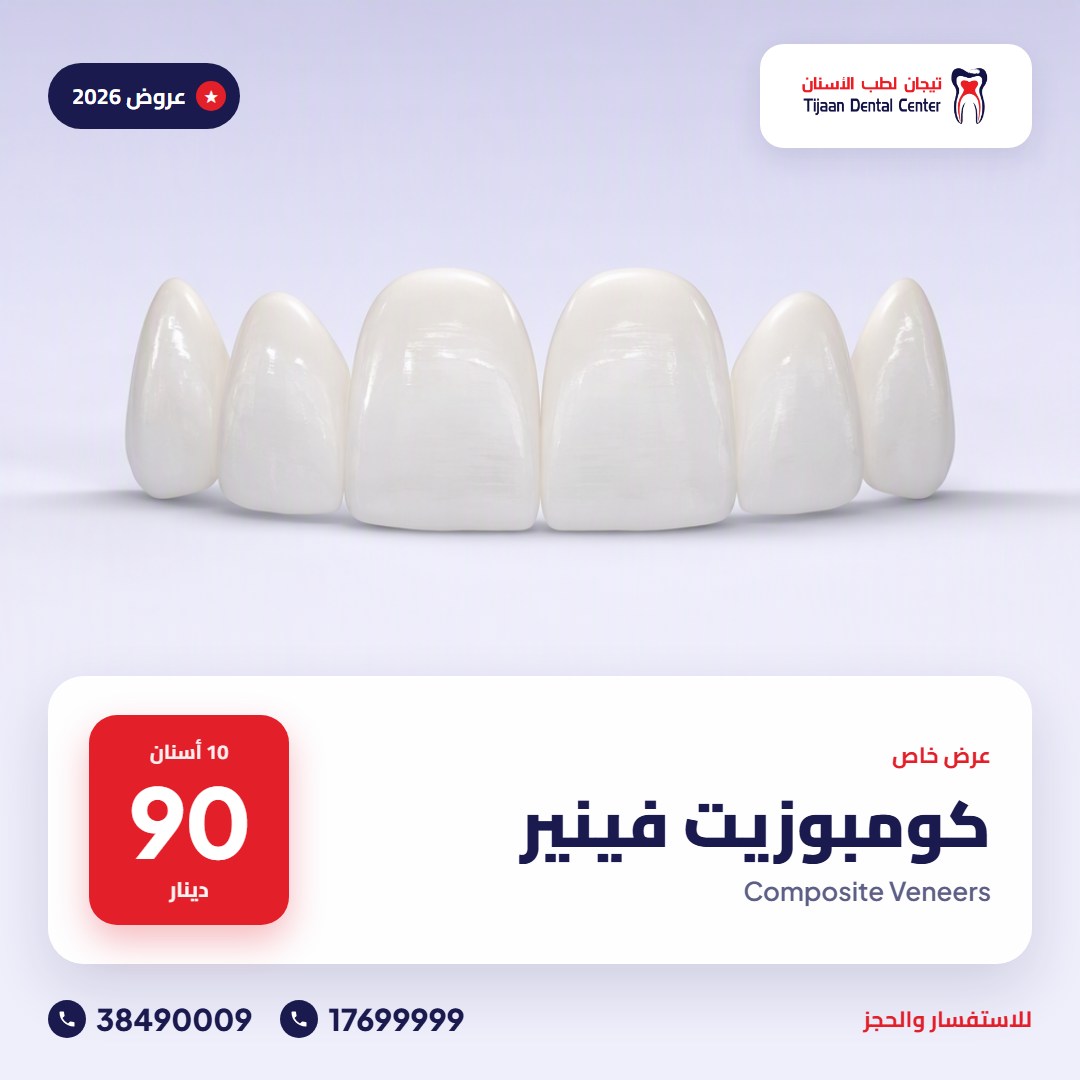 كومبوزيت فينير