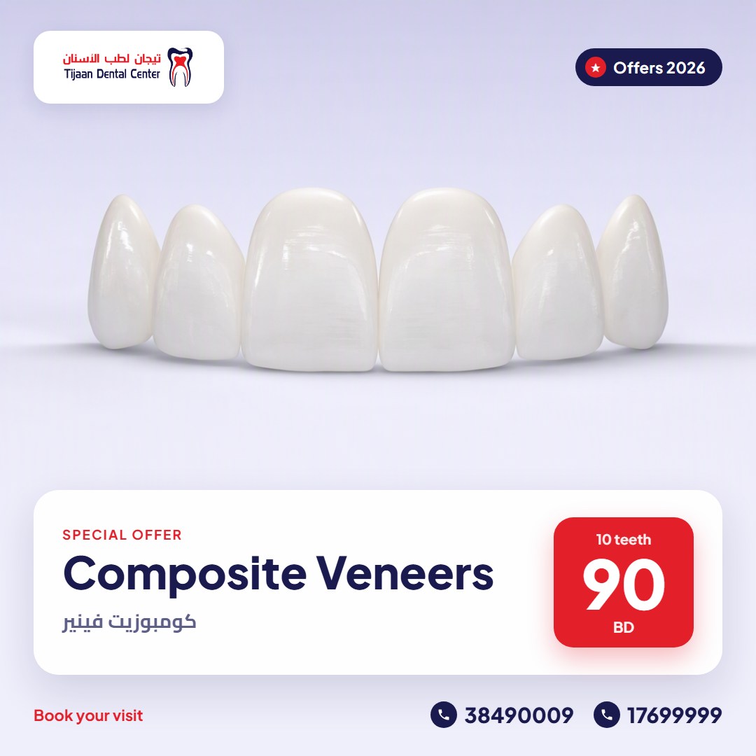 Composite Veneers