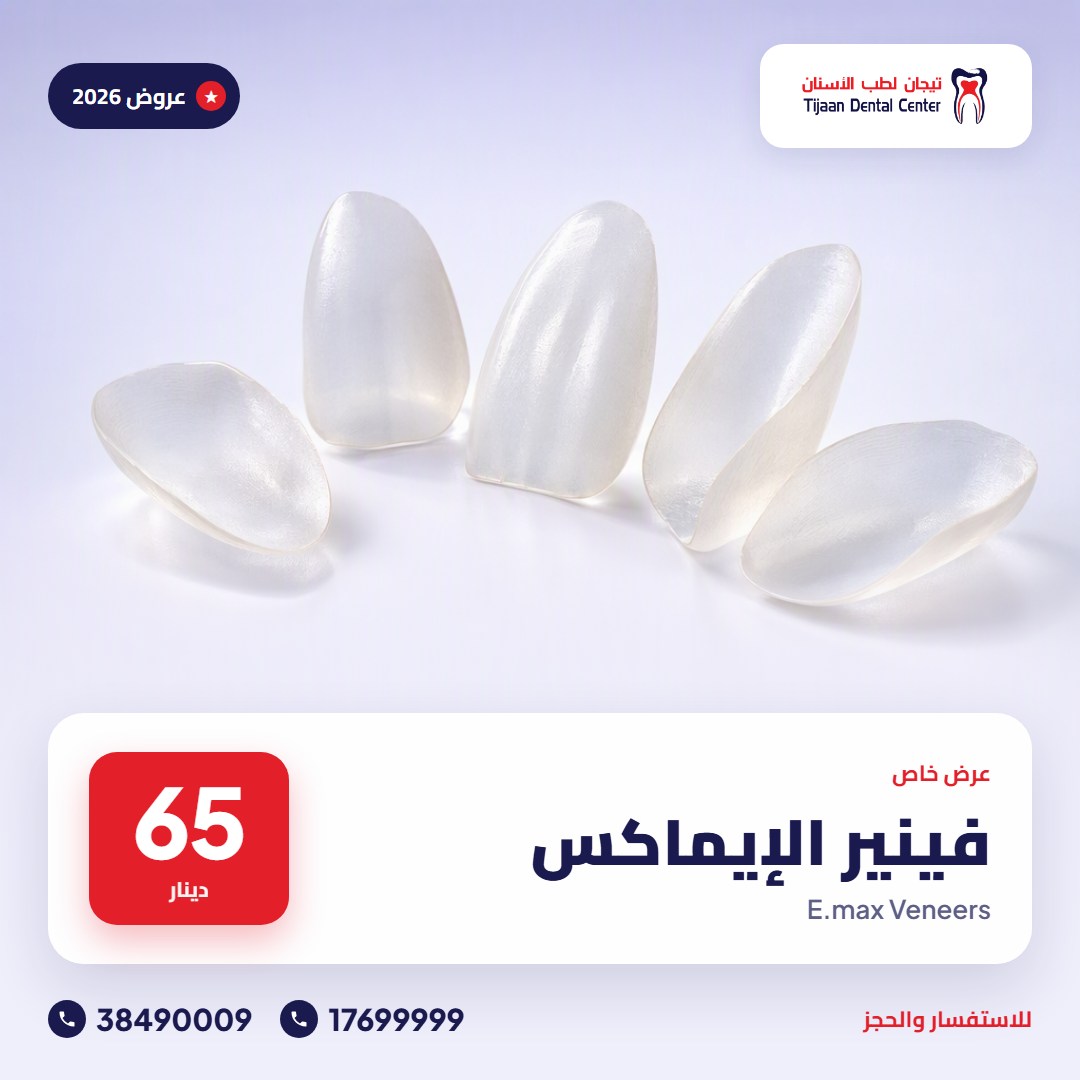 فينير الإيماكس