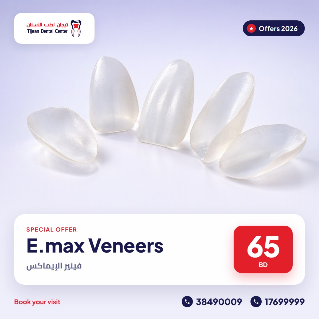 E.max Veneers