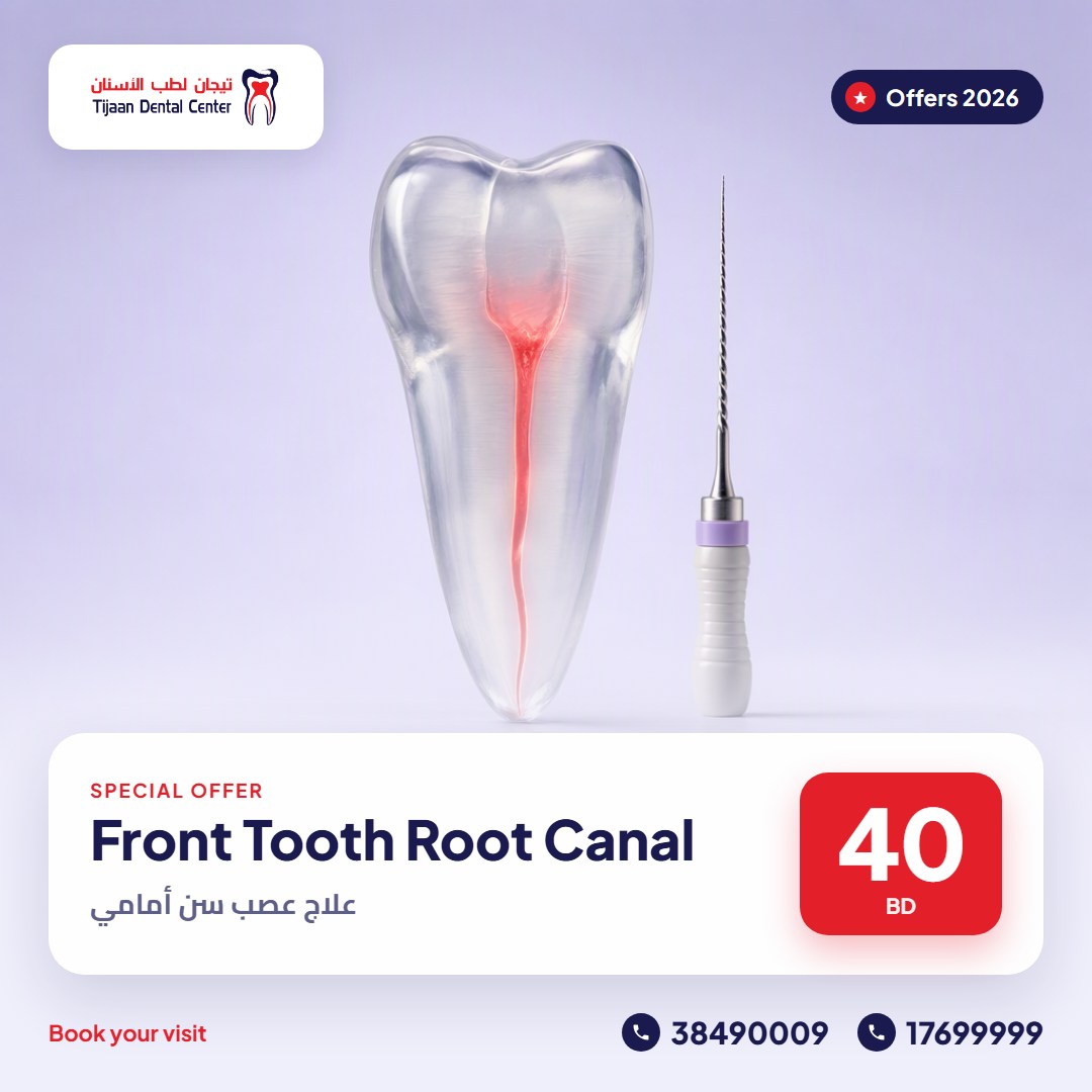 Front Tooth Root Canal – 40 BD